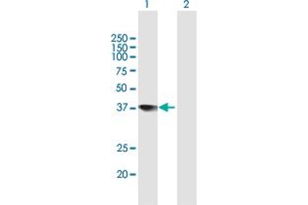 TCEA2 anticorps  (AA 1-299)