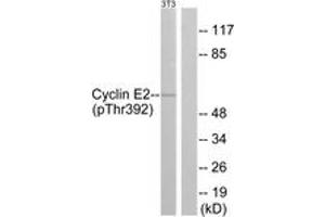 Western Blotting (WB) image for anti-Cyclin E2 (CCNE2) (AA 355-404), (pThr392) antibody (ABIN482177) (Cyclin E2 anticorps  (pThr392))