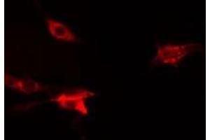 ABIN6275831 staining  Hela cells by IF/ICC. (TRAF2 anticorps  (C-Term))