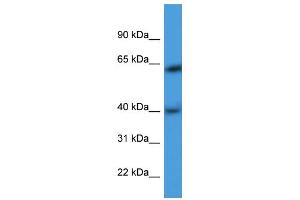 WB Suggested Anti-ARPM1 Antibody Titration: 0. (ARPM1 anticorps  (N-Term))