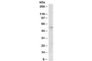 Western blot testing of HepG2 cell lysate with EGR2 antibody at 0. (EGR2 anticorps)