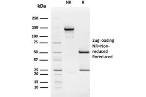 SDS-PAGE Analysis Purified Retinoblastoma (Rb1) Monoclonal Antibody (1F8). (Retinoblastoma 1 anticorps)