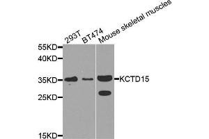 Western blot analysis of extracts of various cell lines, using KCTD15 antibody (ABIN5974815) at 1/1000 dilution. (KCTD15 anticorps)