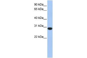WB Suggested Anti-ASB12 Antibody Titration: 0. (ASB12 anticorps  (C-Term))