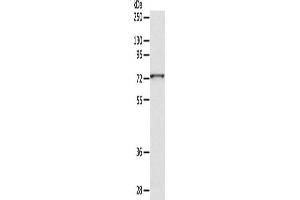 Western Blotting (WB) image for anti-ADAM Metallopeptidase Domain 10 (ADAM10) antibody (ABIN2429028) (ADAM10 anticorps)