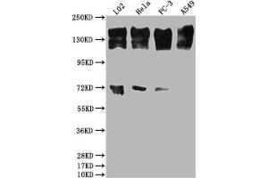 Western Blot Positive WB detected in: L02 whole cell lysate, Hela whole cell lysate, PC-3 whole cell lysate, A549 whole cell lysate All lanes: EGFR antibody at 1:2000 Secondary Goat polyclonal to rabbit IgG at 1/50000 dilution Predicted band size: 135, 45, 78, 70 kDa Observed band size: 165 kDa (Recombinant EGFR anticorps)