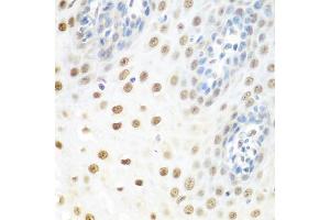 Immunohistochemistry of paraffin-embedded human esophagus using DDX39B antibody (ABIN5974669) at dilution of 1/100 (40x lens). (DDX39B anticorps)