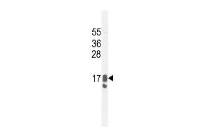 Western blot analysis in MDA-MB231 cell line lysates (35ug/lane). (PIP anticorps  (C-Term))