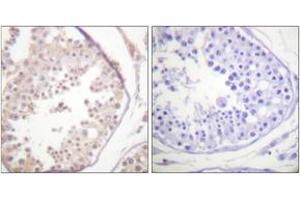 Immunohistochemistry analysis of paraffin-embedded human testis tissue, using RAD52 (Ab-104) Antibody. (RAD52 anticorps  (AA 70-119))