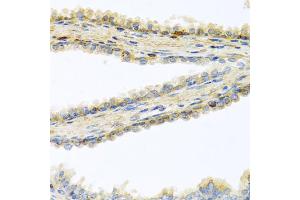 Immunohistochemistry of paraffin-embedded human prostate using GPLD1 antibody. (GPLD1 anticorps)