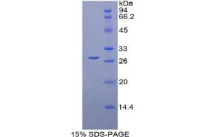 SDS-PAGE analysis of Mouse LOXL1 Protein. (LOXL1 Protéine)