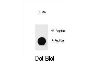 Dot blot analysis of Phospho-PTEN- Antibody Phospho-specific Pab (ABIN6241051 and ABIN6578936) on nitrocellulose membrane. (PTEN anticorps  (pThr366))