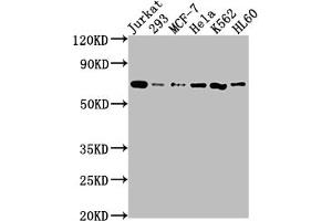Western Blot Positive WB detected in: Jurkat whole cell lysate, 293 whole cell lysate, MCF-7 whole cell lysate, Hela whole cell lysate, K562 whole cell lysate, HL60 whole cell lysate All lanes: PTPN11 antibody at 1:2000 Secondary Goat polyclonal to rabbit IgG at 1/50000 dilution Predicted band size: 69, 53 kDa Observed band size: 69 kDa (Recombinant PTPN11 anticorps)