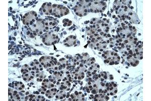 TPTE antibody was used for immunohistochemistry at a concentration of 4-8 ug/ml to stain Epithelial cells of pancreatic acinus (arrows) in Human Pancreas. (TPTE anticorps  (C-Term))