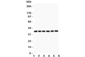 Western blot testing of Crk antibody and Lane 1:  rat spleen;  2: (r) thymus;  3: (r) liver;  4: mouse brain;  5: human HeLa;  6: (h) SMMC-7721 lysate. (Crk anticorps  (AA 2-246))