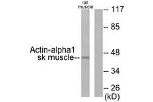 Western Blotting (WB) image for anti-Actin, alpha 1, Skeletal Muscle (ACTA1) (AA 1-50) antibody (ABIN2889169) (Actin anticorps  (AA 1-50))