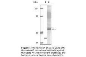Image no. 1 for anti-V-Akt Murine Thymoma Viral Oncogene Homolog 3 (Protein Kinase B, Gamma) (AKT3) antibody (ABIN232105) (AKT3 anticorps)