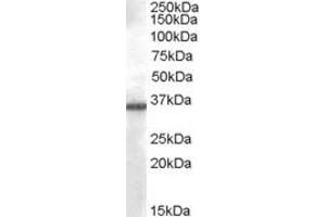 ABIN238673 (0. (AKR1B10 anticorps  (C-Term))