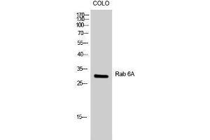 Western Blotting (WB) image for anti-RAB6A, Member RAS Oncogene Family (RAB6A) (Internal Region) antibody (ABIN3186630) (RAB6A anticorps  (Internal Region))