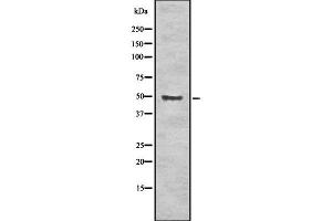 Western blot analysis of ALDH3A1 using K562 whole cell lysates (ALDH3A1 anticorps  (C-Term))