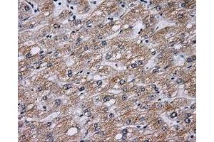 Immunohistochemical staining of paraffin-embedded liver tissue using anti-BTK mouse monoclonal antibody. (BTK anticorps)