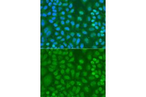 Immunofluorescence analysis of HeLa cells using CXXC1 antibody (ABIN6291907). (CXXC1 anticorps)