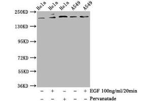 Western Blot Positive WB detected in Hela whole cell lysate,A549 whole cell lysate(treated with EGF or Pervanadate) All lanes Phospho-PDGFRB antibody at 1. (Recombinant PDGFRB anticorps  (pTyr740))