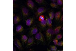 Immunofluorescence (IF) image for anti-Nuclear Factor of kappa Light Polypeptide Gene Enhancer in B-Cells 1 (NFKB1) (pSer337) antibody (ABIN1870464) (NFKB1 anticorps  (pSer337))