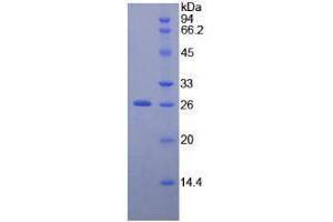 SDS-PAGE analysis of Human NEFM Protein. (NEFM Protéine)