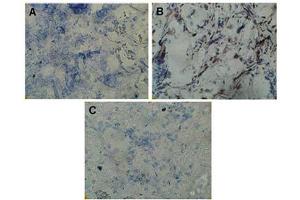 Image no. 1 for anti-Twist Homolog 1 (Drosophila) (TWIST1) (N-Term) antibody (ABIN347415) (TWIST1 anticorps  (N-Term))