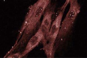 Immunofluorescence staining of WI-38 cells (human lung fibroblasts, ATCC CCL-75). (RAB8A anticorps  (AA 84-205))