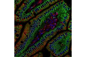 Immunohistochemistry (IHC) image for anti-Catenin (Cadherin-Associated Protein), beta 1, 88kDa (CTNNB1) (N-Term) antibody (ABIN2855042)