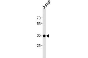 Western Blotting (WB) image for anti-SRY (Sex Determining Region Y)-Box 18 (SOX18) antibody (ABIN2998551) (SOX18 anticorps)