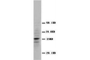 Image no. 2 for anti-Calbindin 2 (CALB2) (N-Term) antibody (ABIN1495049) (Calretinin anticorps  (N-Term))