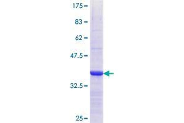 RBP7 Protein (AA 35-134) (GST tag)