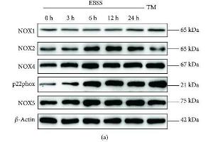 Earle's balanced salt solution (EBSS) increases NADPH oxidative activity and ROS generation in ARPE-19 cells in a time-dependent manner. (CYBB anticorps  (AA 283-570))