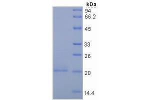 SDS-PAGE analysis of Human Mucin 5AC Protein. (MUC5AC Protéine)