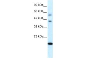 Western Blotting (WB) image for anti-BolA-like Protein 1 (BOLA1) antibody (ABIN2460373) (BOLA1 anticorps)