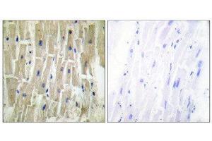 Immunohistochemistry (IHC) image for anti-PDZ and LIM Domain 1 (PDLIM1) (Internal Region) antibody (ABIN1848910) (PDLIM1 anticorps  (Internal Region))