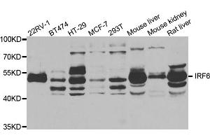 Western blot analysis of extracts of various cell lines, using IRF6 antibody. (IRF6 anticorps)