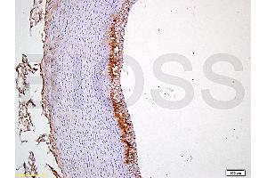 Formalin-fixed and paraffin embedded rabbit carotid artery tissue labeled with Anti-CD54/ICAM-1 Polyclonal Antibody, Unconjugated (ABIN707606) at 1:400 followed by conjugation to the secondary antibody and DAB staining (ICAM1 anticorps  (AA 451-505))