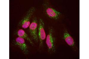 HeLa cells staining with ABIN1580432 (green), and counterstained with ’s chicken polyclonal antibody to Lamin A/C, CPCA-LaminAC (red) and DNA (blue). (LAMP1 anticorps)