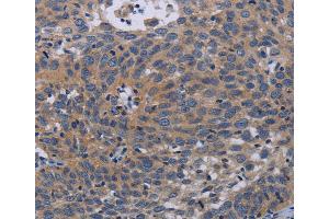 Immunohistochemistry (IHC) image for anti-Pregnancy-Associated Plasma Protein A, Pappalysin 1 (PAPPA) antibody (ABIN2433527) (PAPPA anticorps)