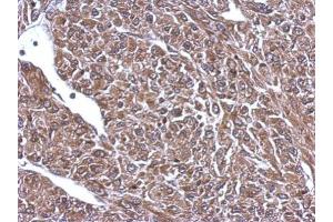 IHC-P Image Immunohistochemical analysis of paraffin-embedded U87 xenograft, using 68kDa Neurofilament Light, antibody at 1:500 dilution. (NEFL anticorps)