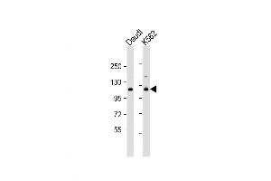 Western Blot at 1:1000 dilution Lane 1: Daudi whole cell lysate Lane 2: K562 whole cell lysate Lysates/proteins at 20 ug per lane. (STAT2 anticorps  (C-Term))
