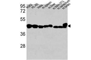 Western Blotting (WB) image for anti-Actin, beta (ACTB) antibody (ABIN658990)