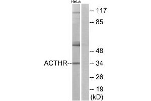 Western blot analysis of extracts from HeLa cells, using ACTHR antibody. (MC2R anticorps  (C-Term))