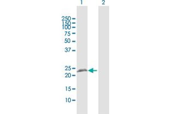 Reticulon 3 anticorps  (AA 1-236)