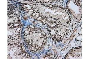 Immunohistochemical staining of paraffin-embedded pancreas tissue using anti-DAPK2 mouse monoclonal antibody. (DAPK2 anticorps)