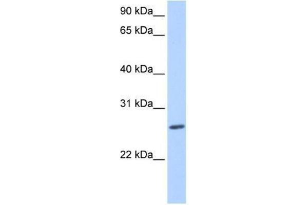 ZNF664 anticorps  (N-Term)